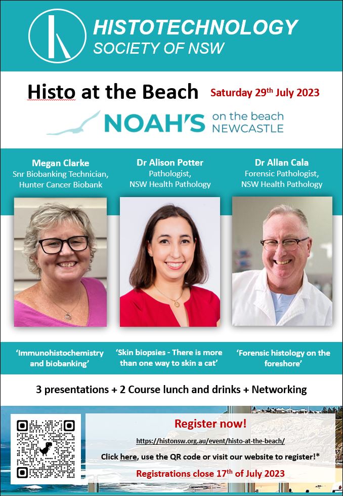 29th July 2023 Histo at the Beach – Newcastle
